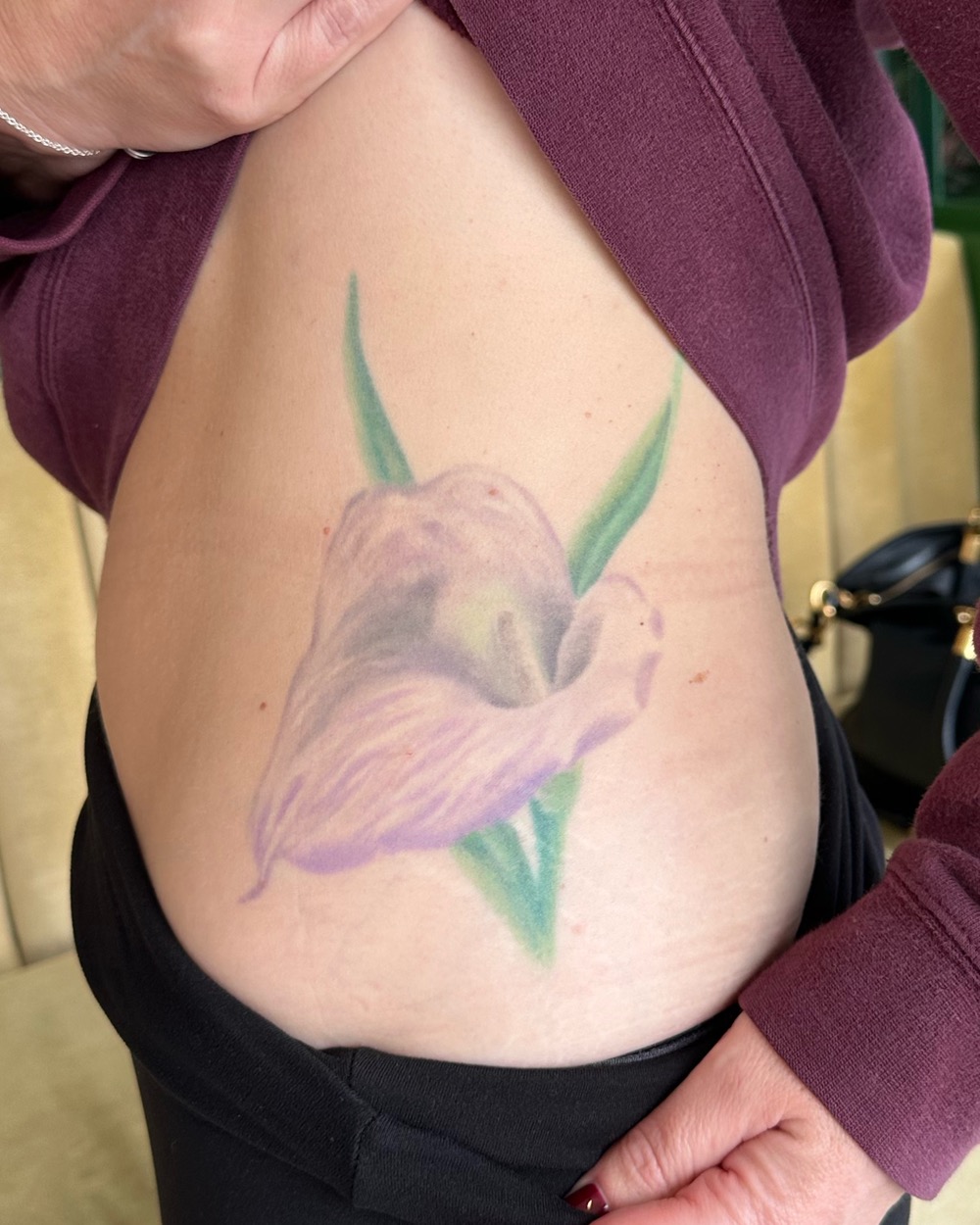 Before: faded calla lily tattoo on ribs